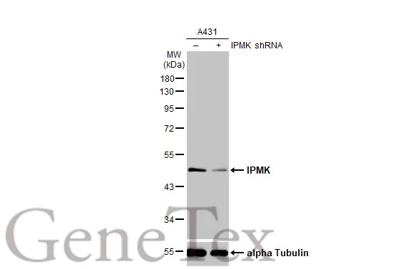 Non-transfected (–) and transfected (+) A431 whole cell extracts (30 μg) were separated by 10% SDS-PAGE, and the membrane was blotted with IPMK antibody [N1C2] (GTX104954) diluted at 1:3000. The HRP-conjugated anti-rabbit IgG antibody (GTX213110-01) was used to detect the primary antibody.
