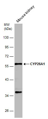 Mouse tissue extract (50 μg) was separated by 10% SDS-PAGE, and the membrane was blotted with CYP26A1 antibody (GTX104961) diluted at 1:1000. The HRP-conjugated anti-rabbit IgG antibody (GTX213110-01) was used to detect the primary antibody.