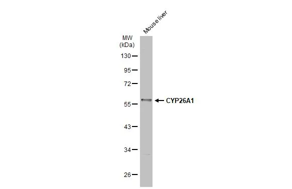 Mouse tissue extract (50 μg) was separated by 10% SDS-PAGE, and the membrane was blotted with CYP26A1 antibody (GTX104961) diluted at 1:1000. The HRP-conjugated anti-rabbit IgG antibody (GTX213110-01) was used to detect the primary antibody.
