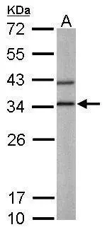 Sample (50 ug of whole cell lysate) A: Mouse liver 12% SDS PAGE GTX104970 diluted at 1:1000 Sample (50 ug of whole cell lysate) A: Mouse liver 12% SDS PAGE GTX104970 diluted at 1:1000