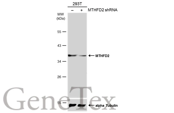Non-transfected (–) and transfected (+) 293T whole cell extracts (30 μg) were separated by 10% SDS-PAGE, and the membrane was blotted with MTHFD2 antibody [N1C3] (GTX104990) diluted at 1:3000. The HRP-conjugated anti-rabbit IgG antibody (GTX213110-01) was used to detect the primary antibody.