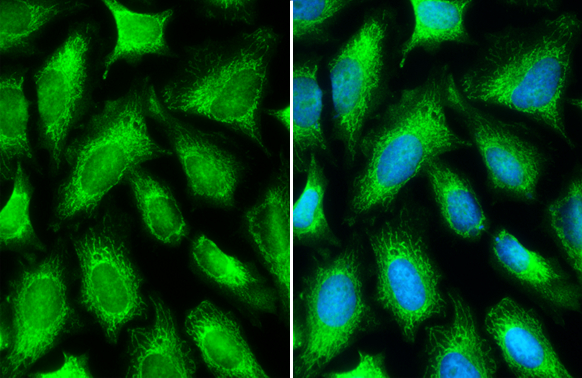 MTHFD2 antibody [N1C3] detects MTHFD2 protein at mitochondria by immunofluorescent analysis. Sample: HeLa cells were fixed in 4% paraformaldehyde at RT for 15 min. Green: MTHFD2 stained by MTHFD2 antibody [N1C3] (GTX104990) diluted at 1:500. Blue: Fluoroshield with DAPI (GTX30920).