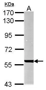 Sample (50 ug of whole cell lysate) A: mouse liver 7.5% SDS PAGE GTX104993 diluted at 1:10000