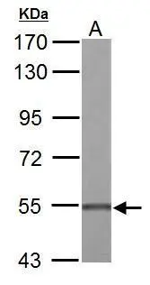 UGDH antibody detects UGDH protein by Western blot analysis. A. 50 μg Rat liver lysate/extract 7.5 % SDS-PAGE UGDH antibody (GTX104993) dilution: 1:2000