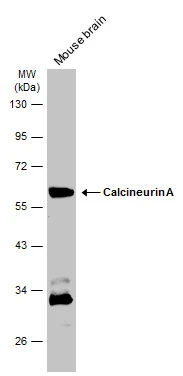 Mouse tissue extract (50 μg) was separated by 10% SDS-PAGE, and the membrane was blotted with Calcineurin A antibody (GTX105003) diluted at 1:1000. The HRP-conjugated anti-rabbit IgG antibody (GTX213110-01) was used to detect the primary antibody.