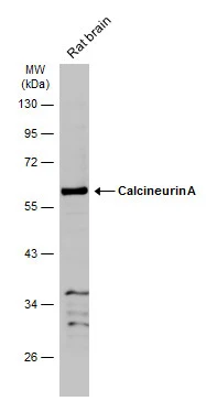 Rat tissue extract (50 μg) was separated by 10% SDS-PAGE, and the membrane was blotted with Calcineurin A antibody (GTX105003) diluted at 1:1000. The HRP-conjugated anti-rabbit IgG antibody (GTX213110-01) was used to detect the primary antibody.