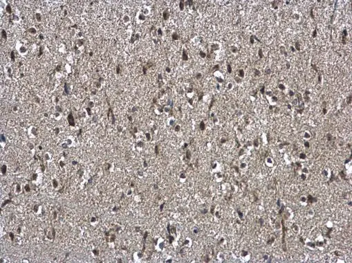 NSFL1C antibody [N1C2] detects NSFL1C protein at cytoplasm and nucleus on mouse brain by immunohistochemical analysis. Sample: Paraffin-embedded mouse brain. NSFL1C antibody [N1C2] (GTX105035) diluted at 1:500. 
 Antigen Retrieval: Trilogy? (EDTA based, pH 8.0) buffer, 15min