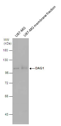 DAG1 antibody detects DAG1 protein by western blot analysis. U87-MG whole cell extracts and membrane extracts (30 μg) were separated by 7.5% SDS-PAGE, and the membrane was blotted with DAG1 antibody (GTX105038) diluted at 1:500. The HRP-conjugated anti-rabbit IgG antibody (GTX213110-01) was used to detect the primary antibody.