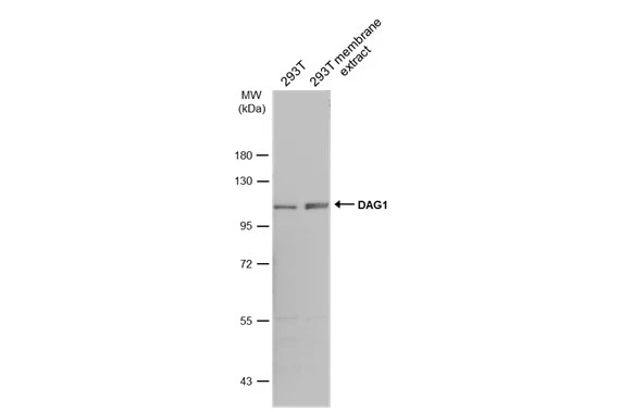 293T whole cell and membrane extracts (30 μg) were separated by 7.5% SDS-PAGE, and the membrane was blotted with DAG1 antibody (GTX105038) diluted at 1:500. The HRP-conjugated anti-rabbit IgG antibody (GTX213110-01) was used to detect the primary antibody.