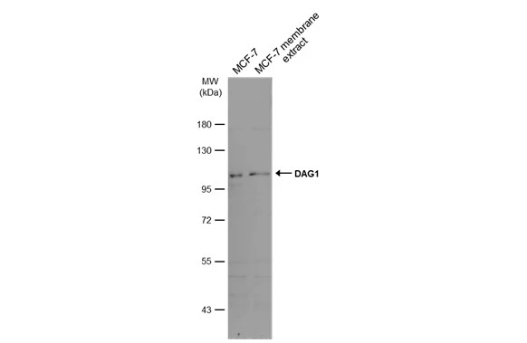 MCF-7 whole cell and membrane extracts (30 μg) were separated by 7.5% SDS-PAGE, and the membrane was blotted with DAG1 antibody (GTX105038) diluted at 1:500. The HRP-conjugated anti-rabbit IgG antibody (GTX213110-01) was used to detect the primary antibody.