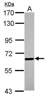 BTD antibody [N3C3] detects BTD protein at cytosol on mouse hind brain by immunohistochemical analysis.Sample:Paraffin-embedded mouse hind brain.BTD antibody [N3C3] (GTX105045) dilution:1:250. Antigen Retrieval:Trilogy? (EDTA based,pH 8.0) buffer,15min