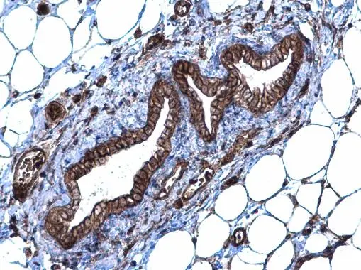 SLC20A1 antibody [N3C2], Internal detects SLC20A1 protein at membrane and cytoplasm on mouse mammary gland by immunohistochemical analysis. Sample: Paraffin-embedded mouse mammary gland. SLC20A1 antibody [N3C2], Internal (GTX105062) diluted at 1:500. 
 Antigen Retrieval: Trilogy? (EDTA based, pH 8.0) buffer, 15min
