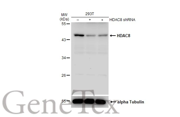 Non-transfected (–) and transfected (+) 293T whole cell extracts (30 μg) were separated by 10% SDS-PAGE, and the membrane was blotted with HDAC8 antibody [N1C2] (GTX105074) diluted at 1:500. The HRP-conjugated anti-rabbit IgG antibody (GTX213110-01) was used to detect the primary antibody.