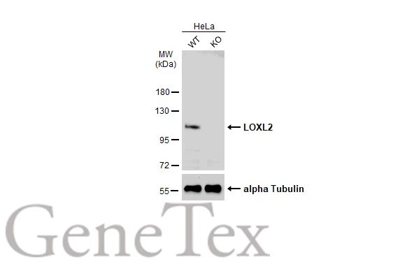苺　0520-1 Amazon.com: BOSCH 0986221135 Ignition Coil - Compatible with