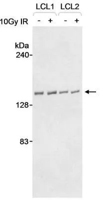 WB analysis of IR treated or non-treated LCL1 and LCL2 cell lysate using GTX10510 RENT1 antibody. Dilution : 1 microg/ml WB analysis of IR treated or non-treated LCL1 and LCL2 cell lysate using GTX10510 RENT1 antibody. Dilution : 1 microg/ml