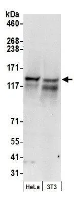 WB analysis of HeLa and NIH-3T3 cell lysate using GTX10510 RENT1 antibody. Dilution : 0.4 ug/ml Loading : 50ug