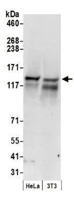 WB analysis of HeLa and NIH-3T3 cell lysate using GTX10510 RENT1 antibody. Dilution : 0.4 microg/ml Loading : 50microg