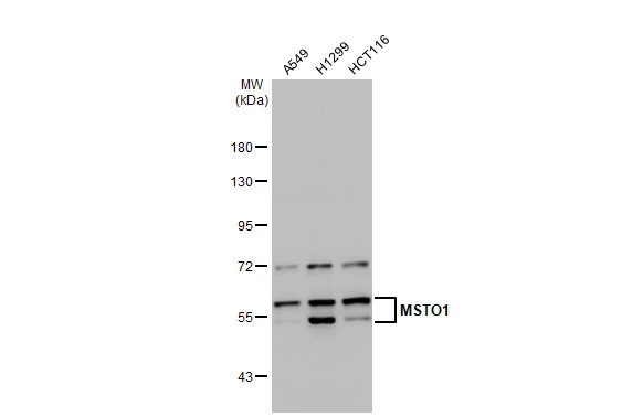 Various whole cell extracts (30 μg) were separated by 7.5% SDS-PAGE, and the membrane was blotted with MSTO1 antibody [N1C1] (GTX105110) diluted at 1:1000. The HRP-conjugated anti-rabbit IgG antibody (GTX213110-01) was used to detect the primary antibody.