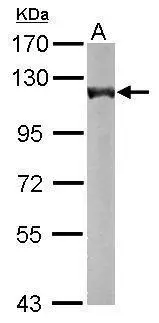 Sample (50 μg of whole cell lysate) A: Mouse brain 7.5% SDS PAGE GTX105124 diluted at 1:5000 The HRP-conjugated anti-rabbit IgG antibody (GTX213110-01) was used to detect the primary antibody.
