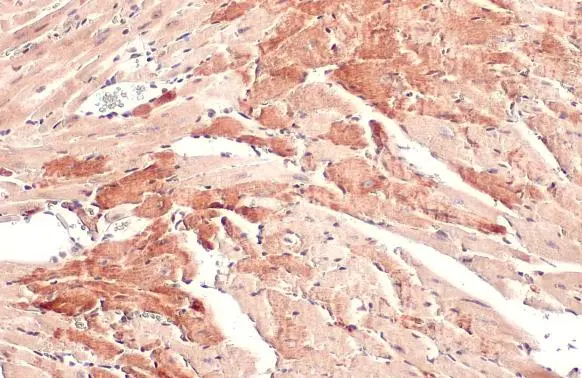OGDH antibody [C2C3], C-term detects OGDH protein at cytoplasm by immunohistochemical analysis. Sample: Paraffin-embedded mouse heart. OGDH stained by OGDH antibody [C2C3], C-term (GTX105124) diluted at 1:500. Antigen Retrieval: Citrate buffer, pH 6.0, 15 min