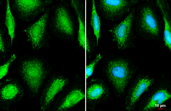 OGDH antibody [C2C3], C-term detects OGDH protein at mitochondria by immunofluorescent analysis. Sample: HeLa cells were fixed in ice-cold MeOH for 5 min. Green: OGDH stained by OGDH antibody [C2C3], C-term (GTX105124) diluted at 1:200. Blue: Fluoroshield with DAPI (GTX30920). Scale bar= 10 μm.