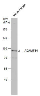 ADAMTS4 antibody detects ADAMTS4 protein by western blot analysis. Mouse tissue extracts (50 μg) was separated by 7.5% SDS-PAGE, and the membrane was blotted with ADAMTS4 antibody (GTX105125) diluted at 1:500.