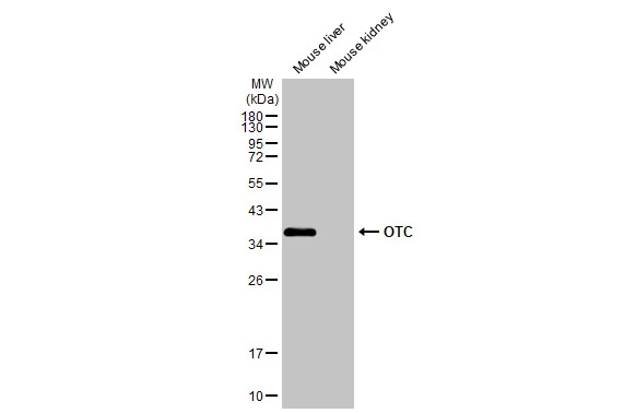 Various tissue extracts (50 μg) were separated by 12% SDS-PAGE, and the membrane was blotted with OTC antibody (GTX105140) diluted at 1:1000. The HRP-conjugated anti-rabbit IgG antibody (GTX213110-01) was used to detect the primary antibody.