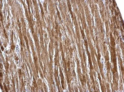 ETFA antibody detects ETFA protein at mitochondria on mouse liver by immunohistochemical analysis. Sample: Paraffin-embedded mouse heart. ETFA antibody (GTX105155) dilution: 1:500. 
 Antigen Retrieval: Trilogy? (EDTA based, pH 8.0) buffer, 15min