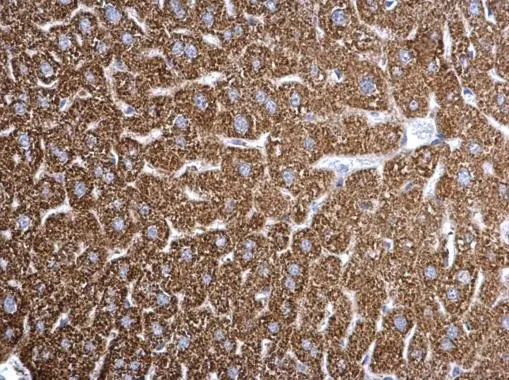ETFA antibody detects ETFA protein at mitochondria on mouse liver by immunohistochemical analysis. Sample: Paraffin-embedded mouse liver. ETFA antibody (GTX105155) dilution: 1:500. 
 Antigen Retrieval: Trilogy? (EDTA based, pH 8.0) buffer, 15min