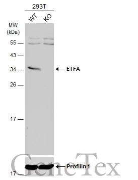 Wild-type (WT) and ETFA knockout (KO) 293T cell extracts (30 μg) were separated by 12% SDS-PAGE, and the membrane was blotted with ETFA antibody (GTX105155) diluted at 1:1000. The HRP-conjugated anti-rabbit IgG antibody (GTX213110-01) was used to detect the primary antibody.