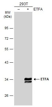 Non-transfected (–) and transfected (+) 293T whole cell extracts (30 μg) were separated by 10% SDS-PAGE, and the membrane was blotted with ETFA antibody (GTX105155) diluted at 1:1000. The HRP-conjugated anti-rabbit IgG antibody (GTX213110-01) was used to detect the primary antibody.