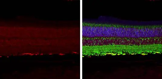 CNGA3 antibody [N3C3] detects CNGA3 protein at cytoplasm by immunohistochemical analysis. Sample: Paraffin-embedded mouse eye. Red: CNGA3 stained by CNGA3 antibody [N3C3] (GTX105162) diluted at 1:250. Green: beta Tubulin 3/ Tuj1, a cytoskeleton marker, stained by beta Tubulin 3/ Tuj1 antibody [GT1338] (GTX631831) diluted at 1:500. Blue: Fluoroshield with DAPI (GTX30920).
 Antigen Retrieval: Citrate buffer, pH 6.0, 15 min