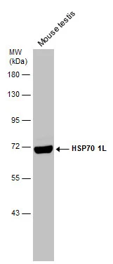 Mouse tissue extract (50 μg) was separated by 7.5% SDS-PAGE, and the membrane was blotted with HSP70 1L antibody [C1C3] (GTX105164) diluted at 1:5000. The HRP-conjugated anti-rabbit IgG antibody (GTX213110-01) was used to detect the primary antibody.