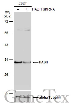 Non-transfected (–) and transfected (+) 293T whole cell extracts (30 μg) were separated by 10% SDS-PAGE, and the membrane was blotted with HADH antibody (GTX105167) diluted at 1:1000. The HRP-conjugated anti-rabbit IgG antibody (GTX213110-01) was used to detect the primary antibody, and the signal was developed with Trident ECL plus-Enhanced.