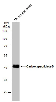 Mouse tissue extract (50 μg) was separated by 10% SDS-PAGE, and the membrane was blotted with Carboxypeptidase B antibody [N1C1] (GTX105170) diluted at 1:3000. The HRP-conjugated anti-rabbit IgG antibody (GTX213110-01) was used to detect the primary antibody.