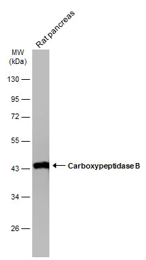 Rat tissue extract (50 μg) was separated by 10% SDS-PAGE, and the membrane was blotted with Carboxypeptidase B antibody [N1C1] (GTX105170) diluted at 1:3000. The HRP-conjugated anti-rabbit IgG antibody (GTX213110-01) was used to detect the primary antibody.