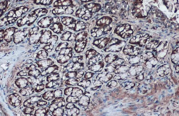 IDH1 antibody detects IDH1 protein at cytoplasm by immunohistochemical analysis. Sample: Paraffin-embedded rat colon. IDH1 stained by IDH1 antibody (GTX105179) diluted at 1:1000. Antigen Retrieval: Citrate buffer, pH 6.0, 15 min