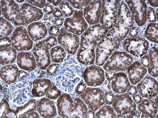 PCCB antibody [N2C3] detects PCCB protein at mitochondria on mouse kidney by immunohistochemical analysis. Sample: Paraffin-embedded mouse kidney. PCCB antibody [N2C3] (GTX105204) diluted at 1:500. 
 Antigen Retrieval: Trilogy? (EDTA based, pH 8.0) buffer, 15min