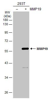 Non-transfected (–) and transfected (+) 293T whole cell extracts (30 μg) were separated by 10% SDS-PAGE, and the membrane was blotted with MMP19 antibody (GTX105217) diluted at 1:1000. The HRP-conjugated anti-rabbit IgG antibody (GTX213110-01) was used to detect the primary antibody.
