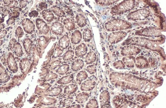 PPP1A antibody detects PPP1A protein at cytoplasm and nucleus by immunohistochemical analysis. Sample: Paraffin-embedded mouse colon. PPP1A stained by PPP1A antibody (GTX105255) diluted at 1:165. Antigen Retrieval: Citrate buffer, pH 6.0, 15 min