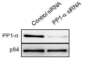 WB to detect PP1 alpha from U2OS cells treated with control siRNA or PP1 alpha siRNA,using GTX105255 at 1:1000 dilution. Nuclear matrix protein p84 is a loading control,blotted with p84 antibody (clone 5E10) GTX70220 at 1:5000 dilution.