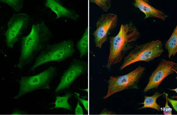 TNFAIP2 antibody [C1C3] detects TNFAIP2 protein at cytoplasm and nucleus by immunofluorescent analysis. Sample: HeLa cells were fixed in 4% paraformaldehyde at RT for 15 min. Green: TNFAIP2 stained by TNFAIP2 antibody [C1C3] (GTX105256) diluted at 1:500. Red: alpha Tubulin, a cytoskeleton marker, stained by alpha Tubulin antibody [GT114] (GTX628802) diluted at 1:1000. Blue: Fluoroshield with DAPI (GTX30920).