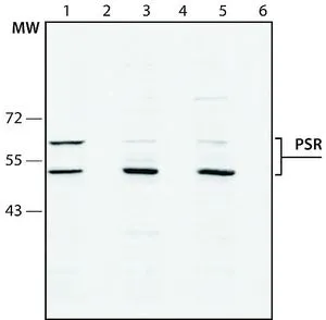 WB analysis of A431 cell lysate using GTX10526 PSR antibody. Lane 1 : Antibody 1 ug/mL Lane 2 : Antibody 1 ug/mL + PSR immunizing peptide