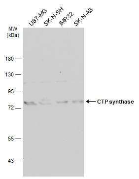 Various whole cell extracts (30 μg) were separated by 7.5% SDS-PAGE, and the membrane was blotted with CTP synthase antibody [N1C1] (GTX105265) diluted at 1:500. The HRP-conjugated anti-rabbit IgG antibody (GTX213110-01) was used to detect the primary antibody, and the signal was developed with Trident ECL plus-Enhanced.