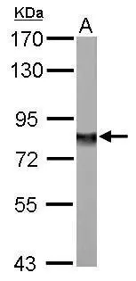NDUFS1 antibody detects NDUFS1 protein by western blot analysis. A. 50 μg rat brain lysate/extract 7.5% SDS-PAGE NDUFS1 antibody (GTX105270) dilution: 1:500 The HRP-conjugated anti-rabbit IgG antibody (GTX213110-01) was used to detect the primary antibody.