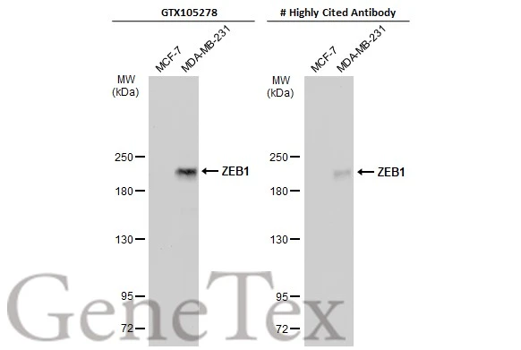 Anti-ZEB1 antibody [N2C1], Internal (GTX105278) | GeneTex
