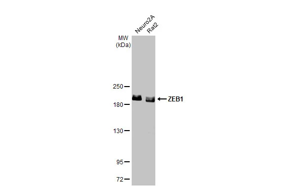 Anti-ZEB1 antibody [N2C1], Internal (GTX105278) | GeneTex
