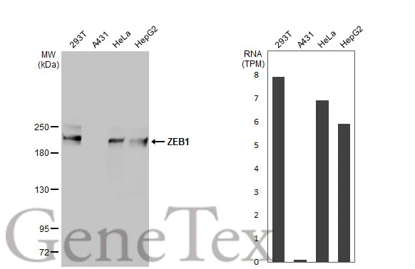 Anti-ZEB1 antibody [N2C1], Internal (GTX105278) | GeneTex