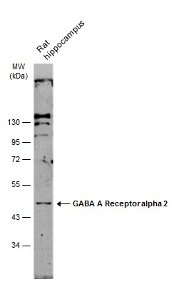 Rat tissue extract (50 μg) was separated by 10% SDS-PAGE, and the membrane was blotted with GABA A Receptor alpha 2 antibody [N1C2] (GTX105282) diluted at 1:500. The HRP-conjugated anti-rabbit IgG antibody (GTX213110-01) was used to detect the primary antibody.