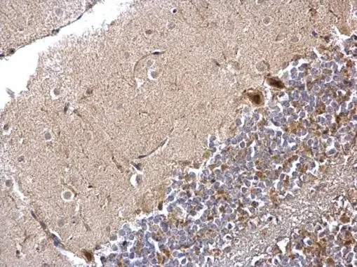PPP1CB antibody detects PPP1CB protein at nucleus and cytosol on mouse lung by immunohistochemical analysis. Sample: Paraffin-embedded mouse lung. PPP1CB antibody (GTX105295) dilution: 1:500. 
 Antigen Retrieval: Trilogy? (EDTA based, pH 8.0) buffer, 15min